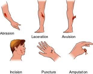 types of wounds.jpg